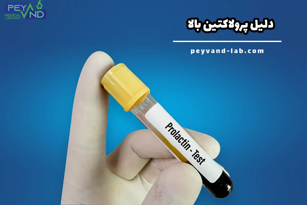 افزایش پرولاکتین (هایپرپرولاکتینمی)